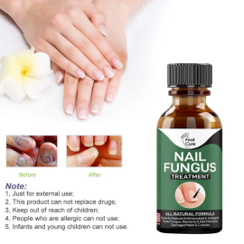 10ml Oil for Nail Fungus